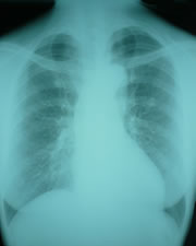 ���������g�Q��